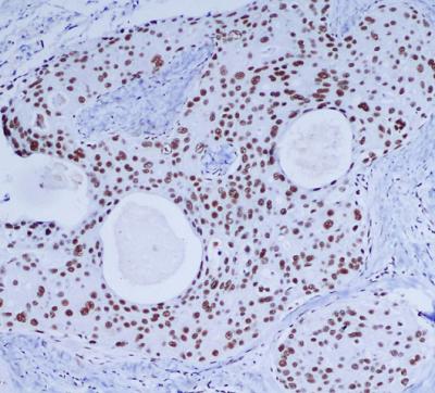 Anti-DNA PKcs (6D1) Mouse Monoclonal Antibody
