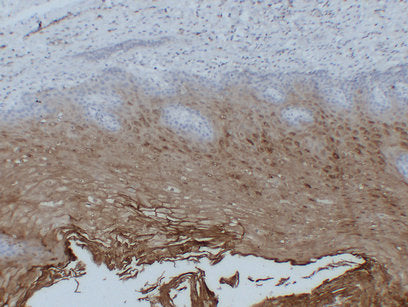 Immunohistochemistry analysis of paraffin-embedded Esophagus using Annexin A1.High-pressure and temperature Sodium Citrate pH 6.0 was used for antigen retrieval.