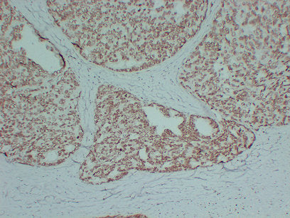 Anti-Androgen Receptor Mouse Monoclonal Antibody