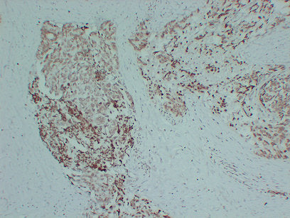Anti-Androgen Receptor Mouse Monoclonal Antibody