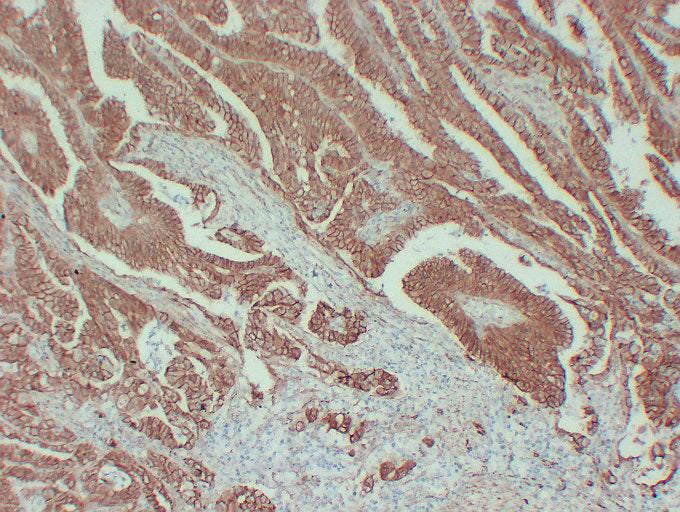 Anti-beta Catenin Mouse Monoclonal Antibody