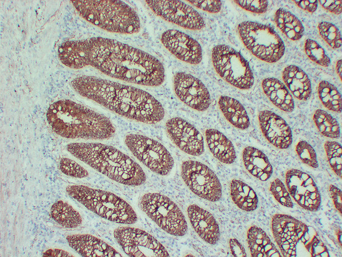 Anti-beta Catenin Mouse Monoclonal Antibody