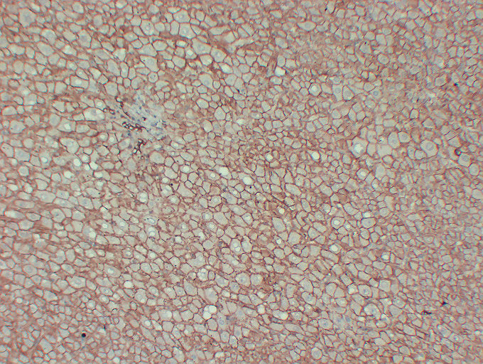 Anti-beta Catenin Mouse Monoclonal Antibody