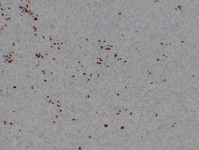 Anti-BOB1 Mouse Monoclonal Antibody