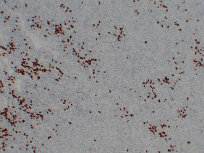 Anti-BOB1 Mouse Monoclonal Antibody