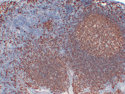 Anti-BOB1 Mouse Monoclonal Antibody