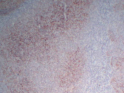 Anti-CD35 Mouse Monoclonal Antibody
