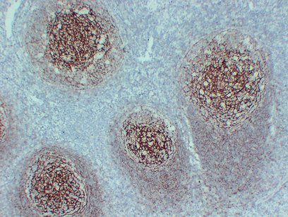 Anti-CD35 Mouse Monoclonal Antibody