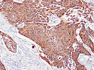 Anti-Cytokeratin 5/6 Mouse Monoclonal Antibody