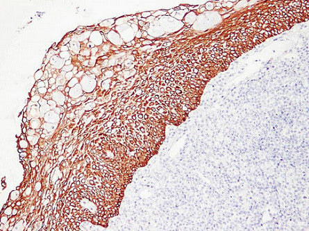 Anti-Cytokeratin 5/6 Mouse Monoclonal Antibody