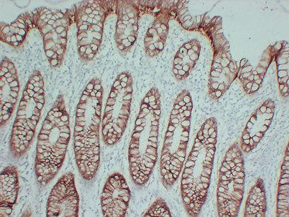 Anti-Claudin 4 Mouse Monoclonal Antibody