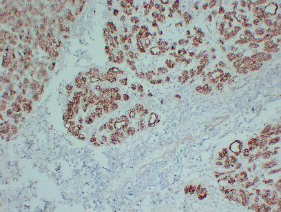 Anti-Claudin 4 Mouse Monoclonal Antibody
