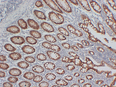 Anti-Claudin 3 Mouse Monoclonal Antibody