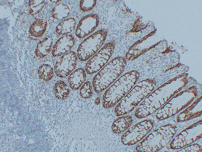 Anti-Claudin 3 Mouse Monoclonal Antibody