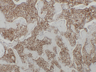Anti-Cadherin 16 Mouse Monoclonal Antibody