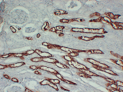 Anti-Cadherin 16 Mouse Monoclonal Antibody