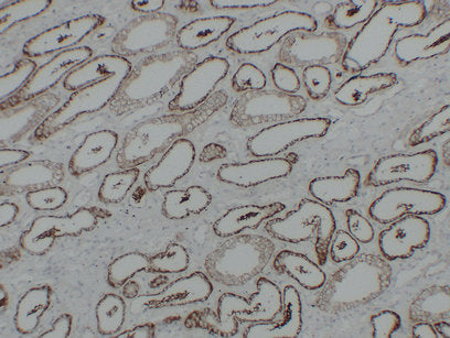 Anti-Cadherin 16 Mouse Monoclonal Antibody