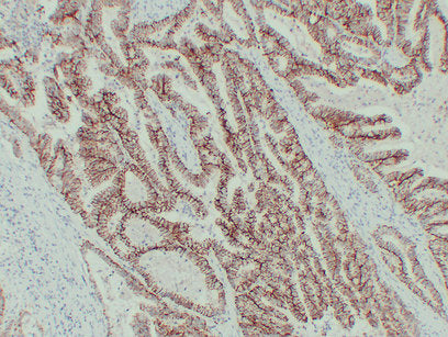 Anti-Claudin 7 Mouse Monoclonal Antibody