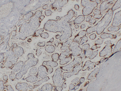 Anti-Choriogonadotropin Subunit beta 3/7 Mouse Monoclonal Antibody