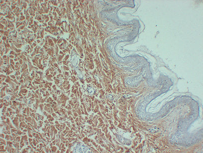 Anti-Collagen III alpha 1 Mouse Monoclonal Antibody
