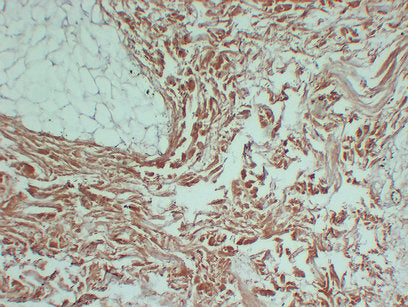 Anti-Collagen III alpha 1 Mouse Monoclonal Antibody
