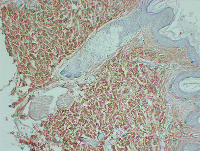 Anti-Collagen III alpha 1 Mouse Monoclonal Antibody
