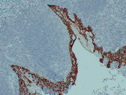 Anti-Cytokeratin 14 Mouse Monoclonal Antibody