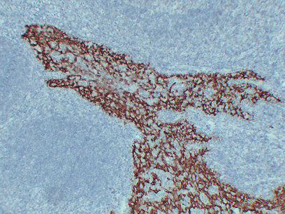 Anti-Cytokeratin 14 Mouse Monoclonal Antibody