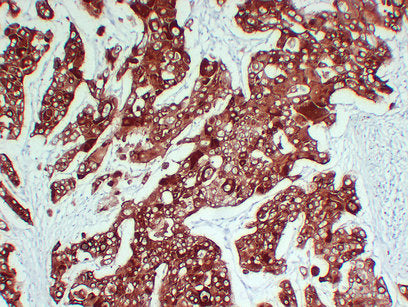 Anti-Cytokeratin 6A Mouse Monoclonal Antibody