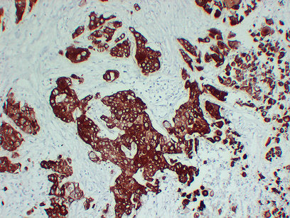 Anti-Cytokeratin 6A Mouse Monoclonal Antibody