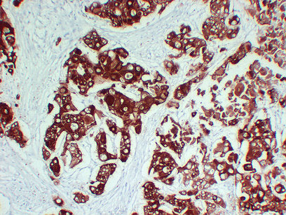 Anti-Cytokeratin 6A Mouse Monoclonal Antibody