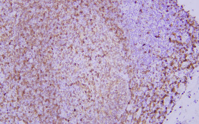 Anti-CD74 Mouse Monoclonal Antibody