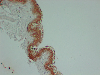 Anti-Cytokeratin 1 Mouse Monoclonal Antibody