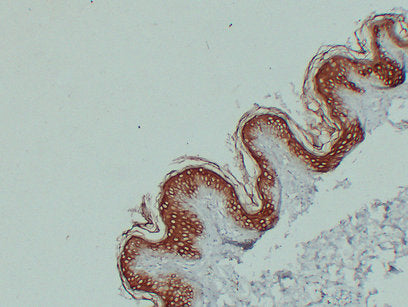 Anti-Cytokeratin 1 Mouse Monoclonal Antibody