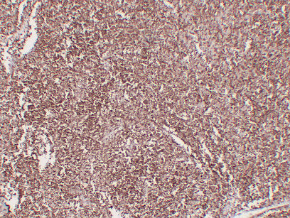 Anti-CD1a Mouse Monoclonal Antibody