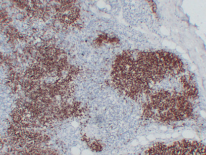 Anti-CD1a Mouse Monoclonal Antibody