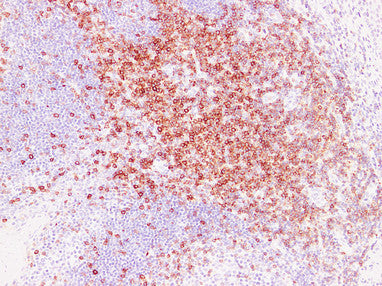Anti-CD5 Mouse Monoclonal Antibody