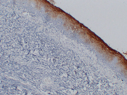 Anti-Carcino Embryonic Antigen CEA Mouse Monoclonal Antibody