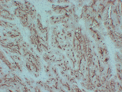 Anti-Carcino Embryonic Antigen CEA Mouse Monoclonal Antibody