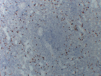 Anti-CD14  Mouse Monoclonal Antibody