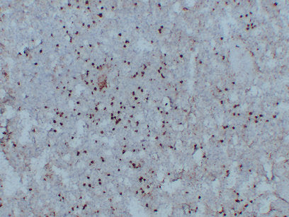 Anti-CD14  Mouse Monoclonal Antibody