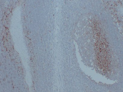 Anti-CD14  Mouse Monoclonal Antibody