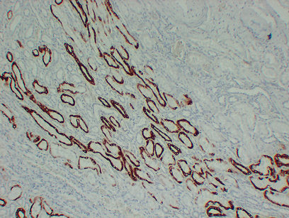 Anti-Cytokeratin 19 Mouse Monoclonal Antibody