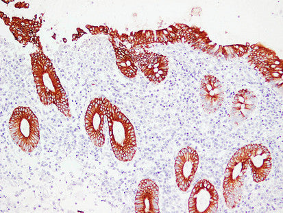 Anti-Cytokeratin 19 Mouse Monoclonal Antibody