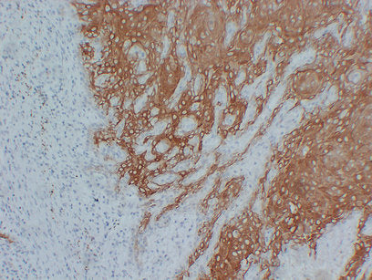 Anti-Cytokeratin 16 Mouse Monoclonal Antibody