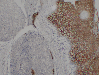 Anti-Cytokeratin 16 Mouse Monoclonal Antibody