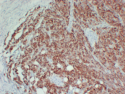 Anti-CD63 Mouse Monoclonal Antibody