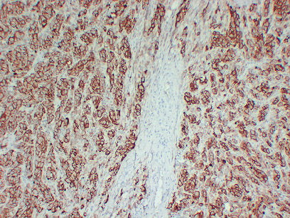 Anti-CD63 Mouse Monoclonal Antibody