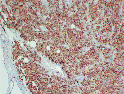 Anti-CD63 Mouse Monoclonal Antibody