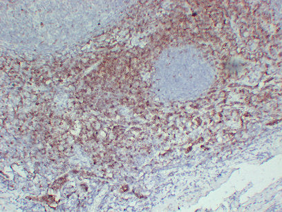 Anti-CD7 Mouse Monoclonal Antibody